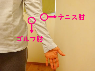 肘の痛み