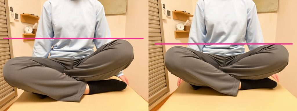 股関節の硬さが腰痛に影響